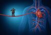 cuore Infarto del miocardio e terapie