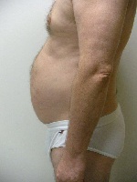 Zerona PD_18_150x200