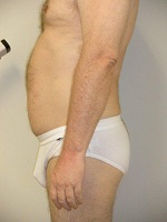 Zerona PD_19_150x200