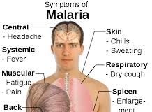 MALARIA