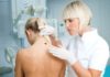melanoma allarme prevenzione