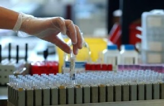 Prelievo Analisi Del Sangue prelievo analisi del sangue