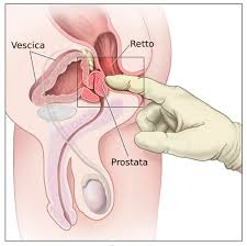 Prostata PROSTATA