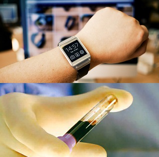 Smartwatch Prelievo Sangue smartwatch prelievo sangue