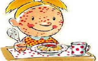 allergie e intolleranze alimentari