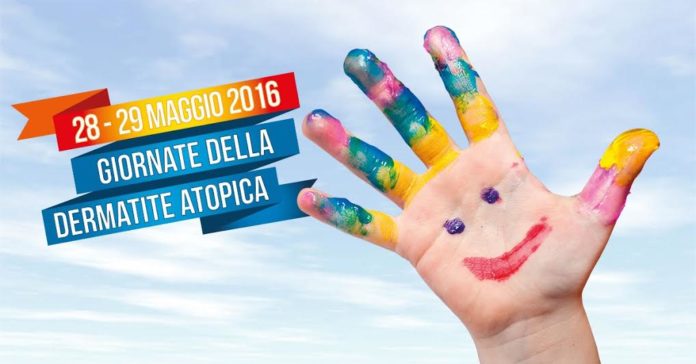 Giorni Dermatite Atopica giorni dermatite atopica