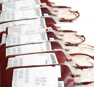 cellule staminali cordone ombelicale 2