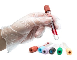 analisi del sangue