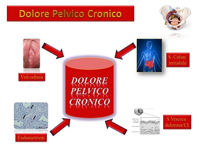 dolore pelvico cronico