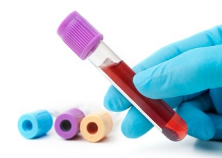 Analisi Del Sangue analisi del sangue