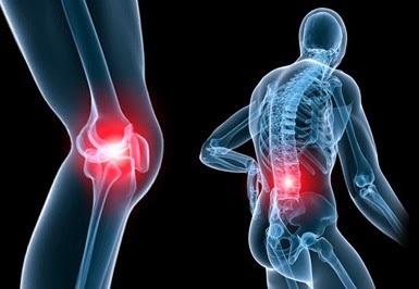 Osteoartrite osteoartrite