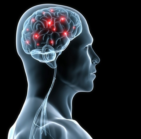 Epilessia epilessia