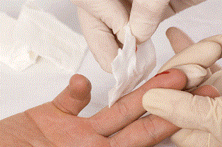 I nuovi antidiabetici che eliminano il glucosio attraverso le urine