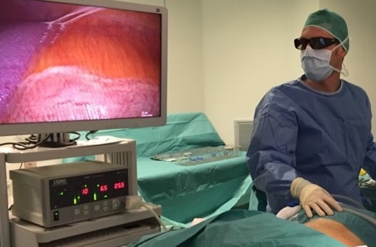 Tumore al rene la laparoscopia diventa in 3D