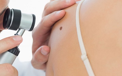 Quindici milioni di italiani soffrono di malattie della pelle