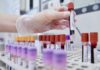 Quali sono tutti gli esami di laboratorio da fare? provette sangue