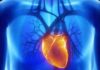 Convegno Cardiologia - Lo shock cardiogeno uccide r