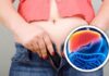 Donne Con Fegato Grasso Piu A Rischio Di Ictus Cerebrale E Di Infarto