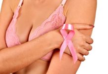 tumore del seno lobulare Carcinoma mammario lobular breast cancer