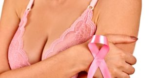tumore del seno lobulare Carcinoma mammario lobular breast cancer