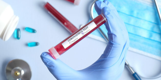 Nuovo coronavirus no agli allarmismi