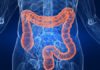 disintossicazione intestinale