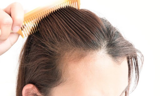 La Perdita Di Capelli Agire Alla Radice Del Bulbo 2 La perdita di capelli - agire alla radice del bulbo 2