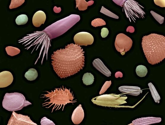 Mixture Of Flower And Grass Seeds, Coloured Scanning Electron Micrograph (sem). This Is A Mixture Of Seeds For Wild Meadow Plants. It Includes Flower And Grass Seeds. Magnification: X200 When Printed 10 Centimetres Wide.