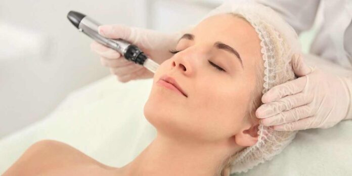 Microneedling