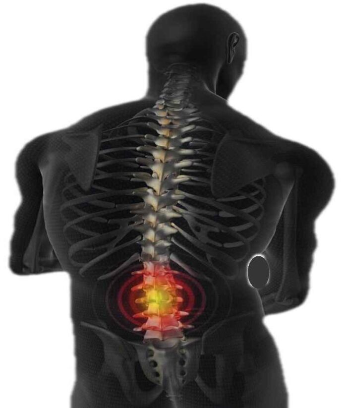 Dolore Termico Dolore Meccanico Percezione Midollo Spinale Compressed