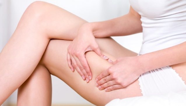 Criolipolisi - trattamenti di Medicina estetica