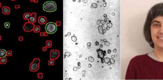 CORVO elaborated unibz Fibrosi cistica - al microscopio Paola Lecca