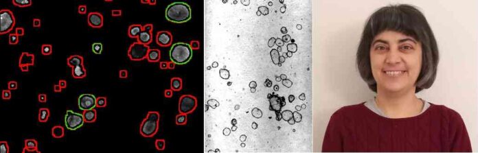 CORVO elaborated unibz Fibrosi cistica - al microscopio - la ricercatrice Paola Lecca CORVO elaborated unibz Fibrosi cistica - al microscopio Paola Lecca