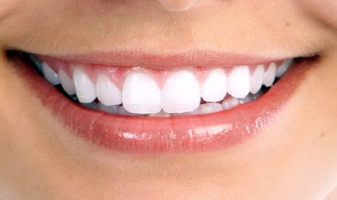 Sorriso dopo la cura di ascessi dentali