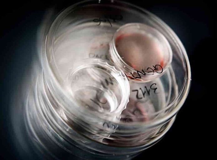 TRAPIANTO APLOIDENTICO con staminali