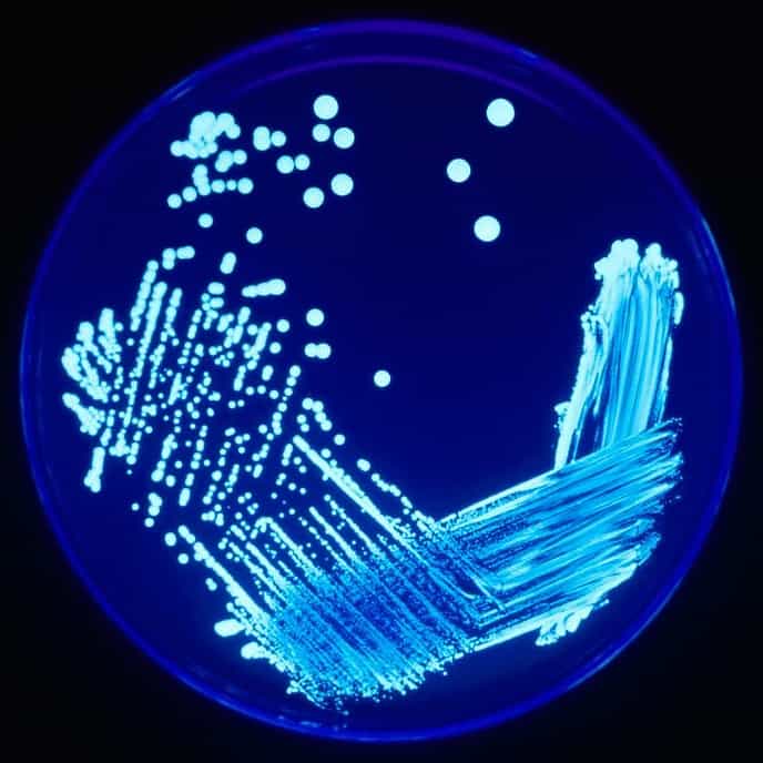 Legionella Plate Legionella Plate