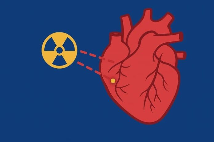 Radioterapia stereotassica nuova cura per aritmie gravi Radioterapia stereotassica nuova cura per aritmie gravi