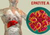 VIRUS EPATITE A