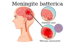 Meningite