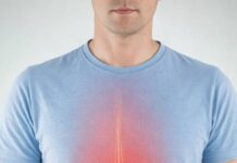 Digestione, esofagite eosinofila: diagnosi ritardi rischi