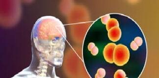 Meningite nel Parmense